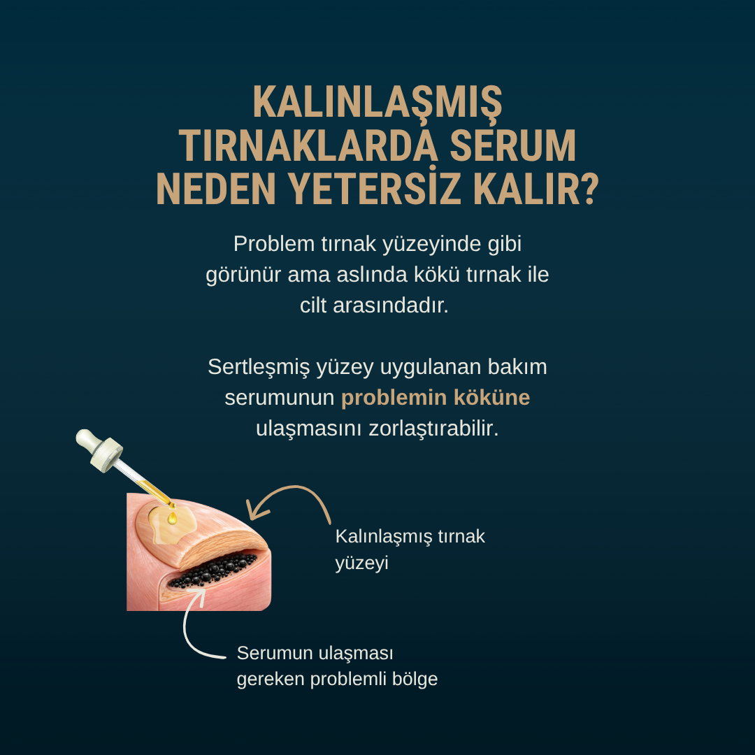 Petros Kerato-Prep Gel | Tırnak Yumuşatıcı Ön Hazırlık Jeli