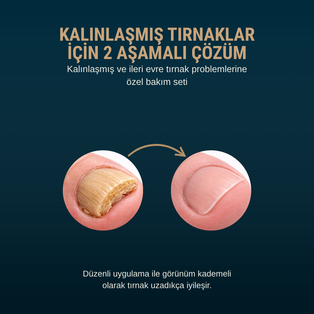 Petros 2 Aşamalı Tırnak Onarım Protokolü