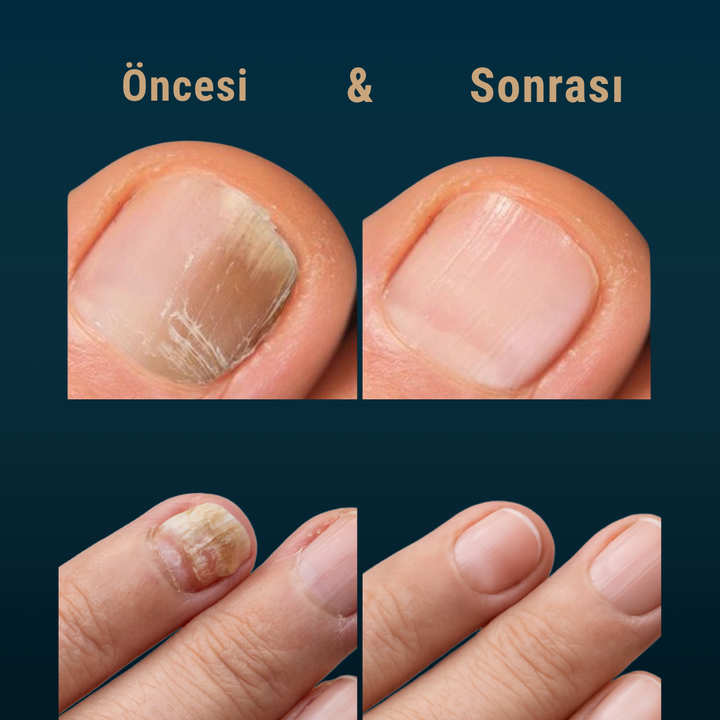 Petros Yoğun Tırnak Bakım Serumu