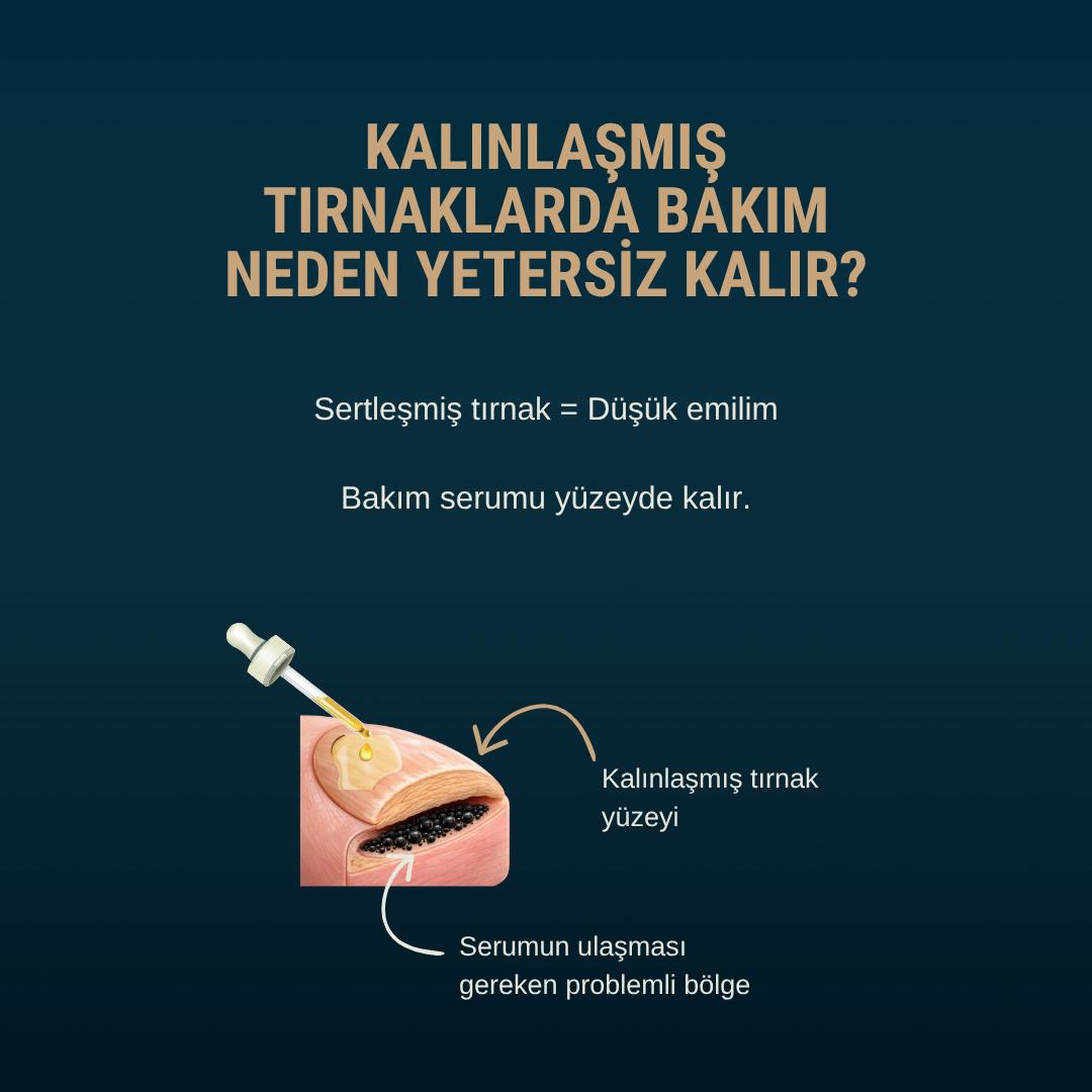 Petros 2 Aşamalı Tırnak Onarım Protokolü